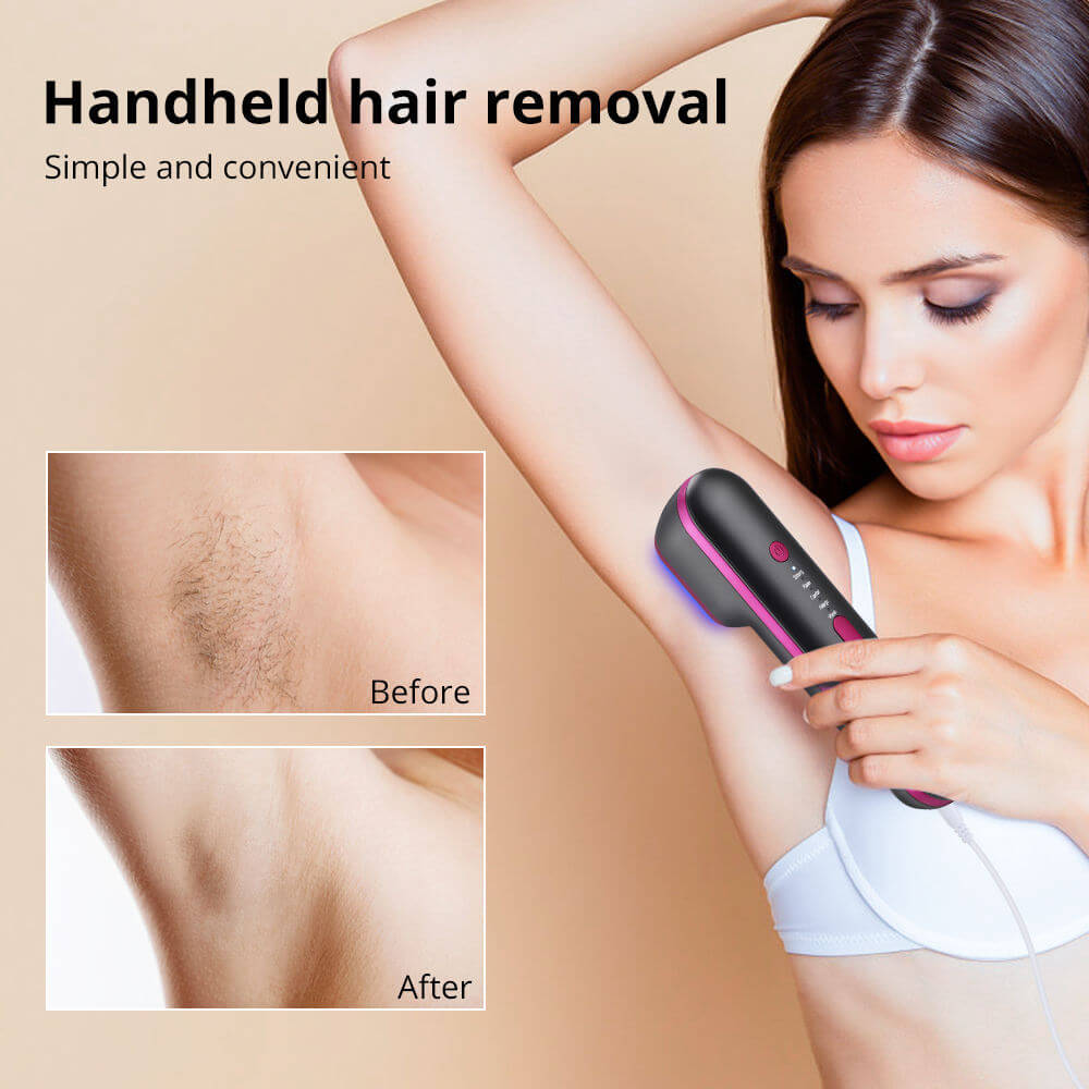 Handheld IPL laser hair removal device showing results before and after treatment, highlighting simplicity and effectiveness.